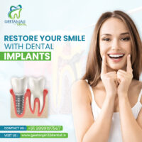 Thumbnail for the listing's main image