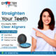 Invisalign Specialist in Gurgaon for Clear Teeth Alignment
